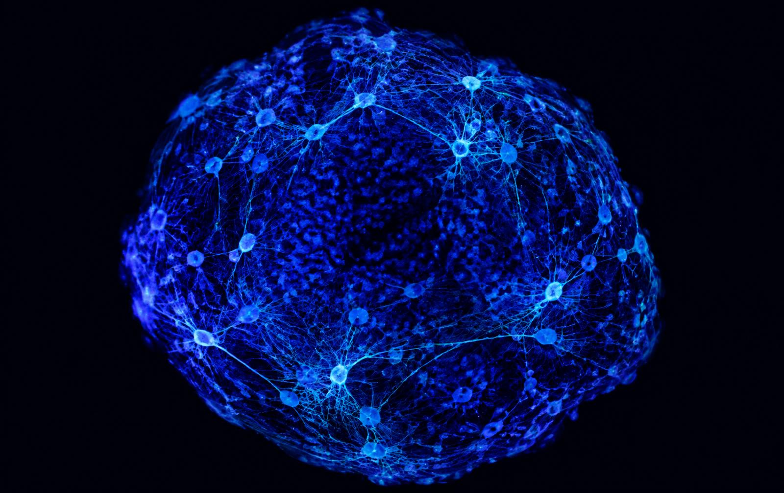 Fluorescent human neural organoid